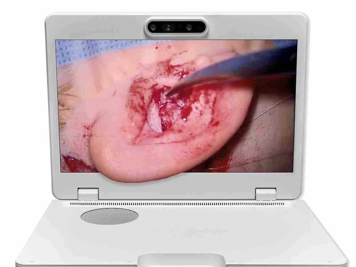 达擎之＂Heads-up 3D显微手术显示系统＂，，整合4K裸眼3D显示及眼球追踪系统，，，具备快速追踪人眼移动位置功能，，，，减轻医师长时间维持固定姿势的负担，，，，让医师能有更宽广清晰的3D立体视野及更舒适的姿势来执行手术。。